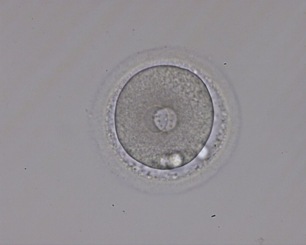 Mikroskopische Aufnahme einer befruchteten Eizelle während der Kryokonservierung
